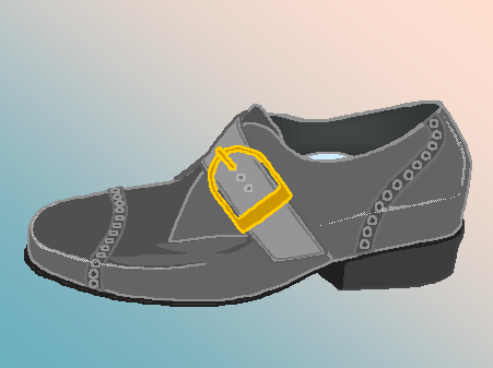 Lateral View Poliomyelitis